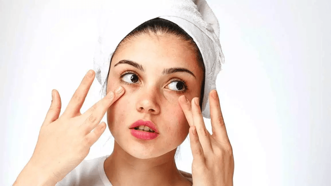 Monsoon Skin Care for Oily Skin- Tips and Tricks From a Dermat